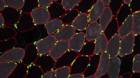 A microscopy image of stained, cross-sectional view of human skeletal muscle tissue.