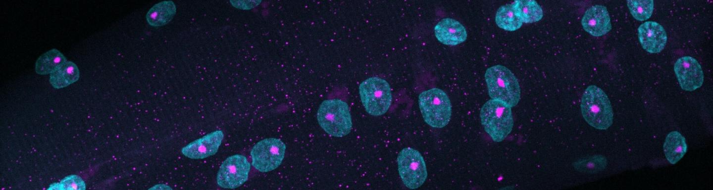Dissected muscle cell under microscopy with the nuclei stained blue.