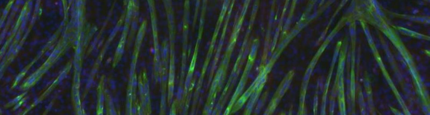 Muscle stem cells under a fluorescent microscope staining solution.