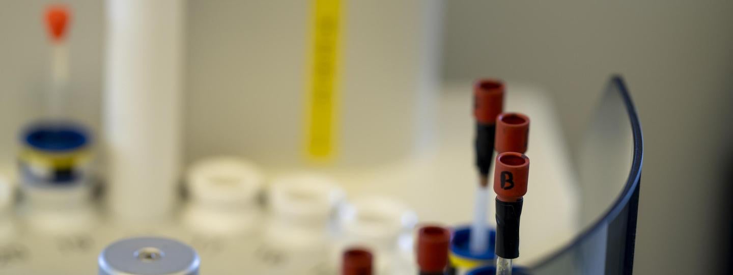 A close up of samples in glass tubes being loaded into a tray.