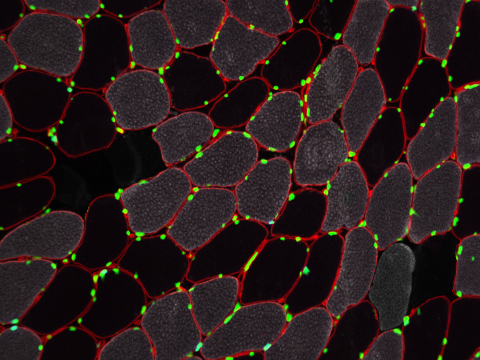 A microscopy image of stained, cross-sectional view of human skeletal muscle tissue.