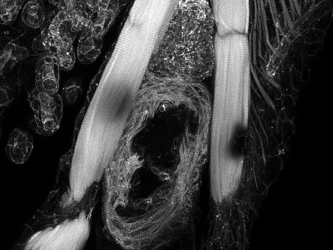 A cross-sectional view of the heart of a zebrafish.