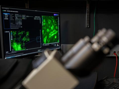 A biological sample image on a computer with a microscope in the foreground.