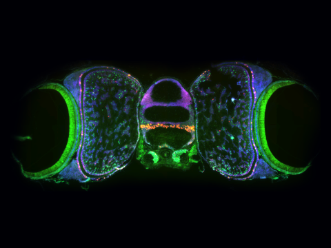 A fluorescent image of an octopus brain.