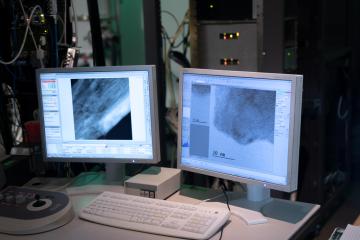 two computer screens show microscope images on them in black and white