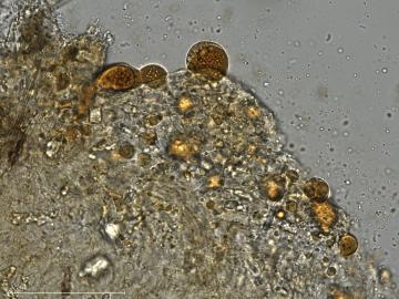 Microscopic oil bodies in a fungal crust under a microscope