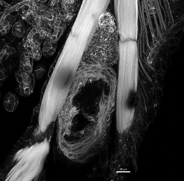 A cross-sectional view of the heart of a zebrafish.